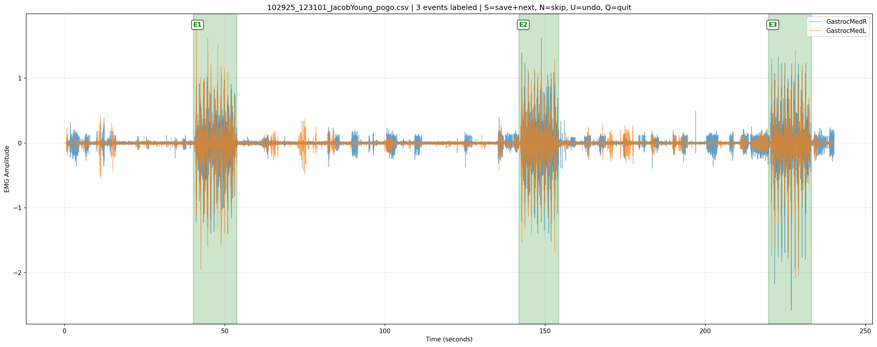 EMG Processing Pipeline